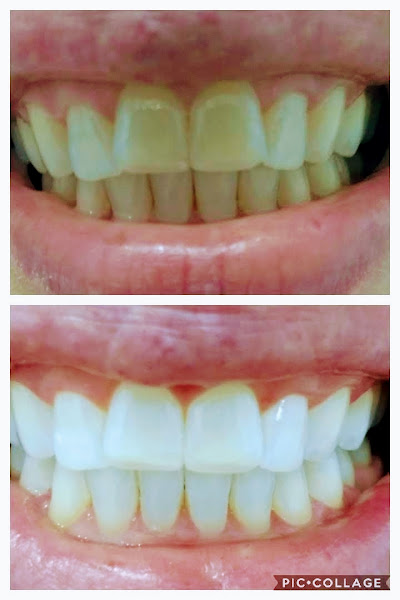 Foto 3 de Odontoméier