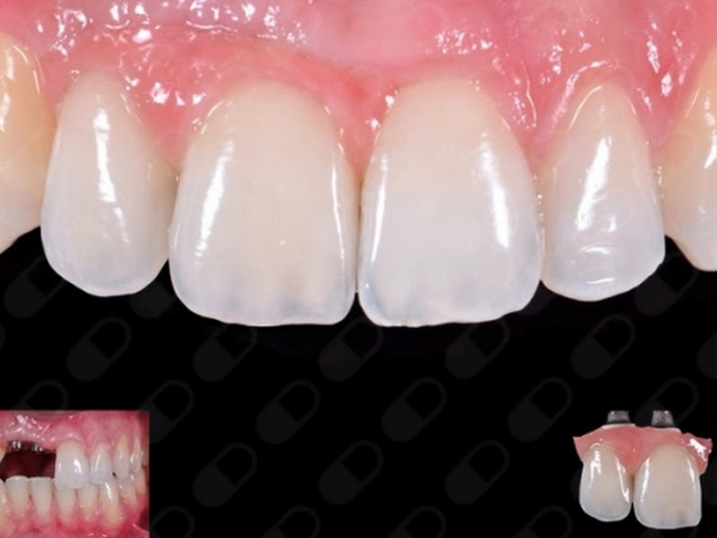 Foto 7 de Odontomicroscopia