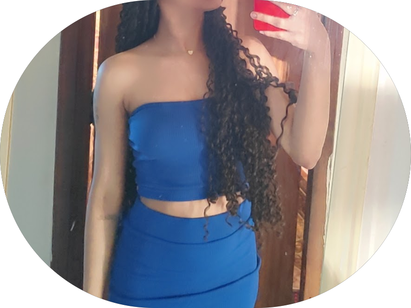 Foto 5 de Odontonobre Ipatinga | Prótese, Restauração, Canal, Faceta em Resina