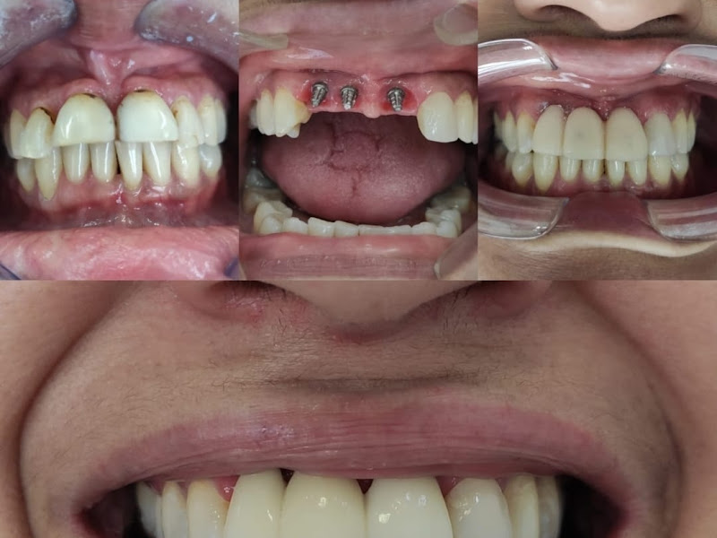 Foto 8 de OdontoPalmira