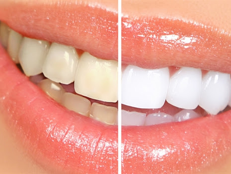 Foto 3 de Odontophlus