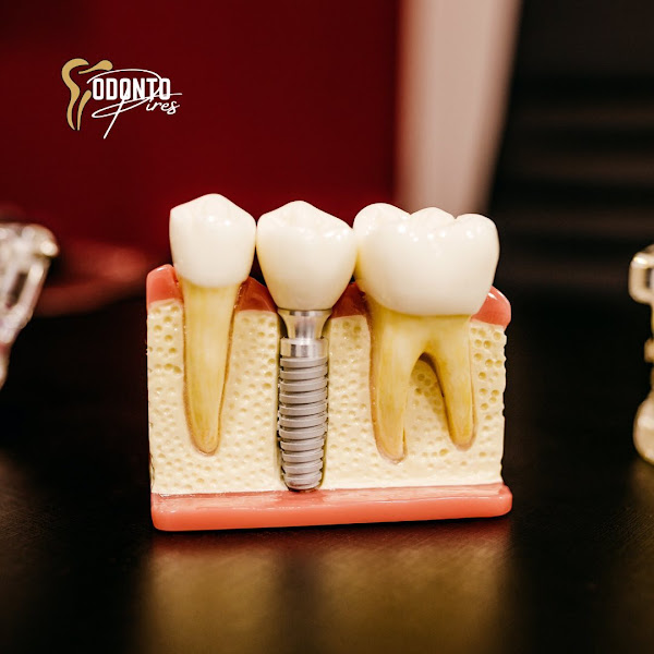 Foto 3 de OdontoPires