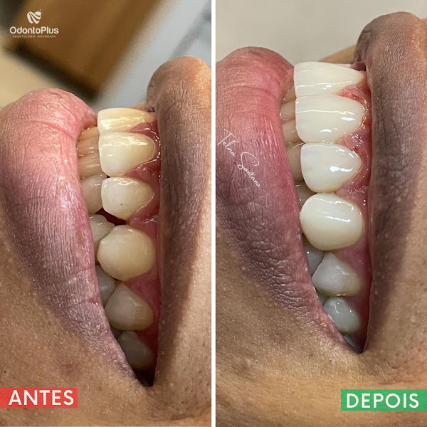 Foto 2 de OdontoPlus - Clínica Odontológica em Alagoinhas / Dentista em Alagoinhas