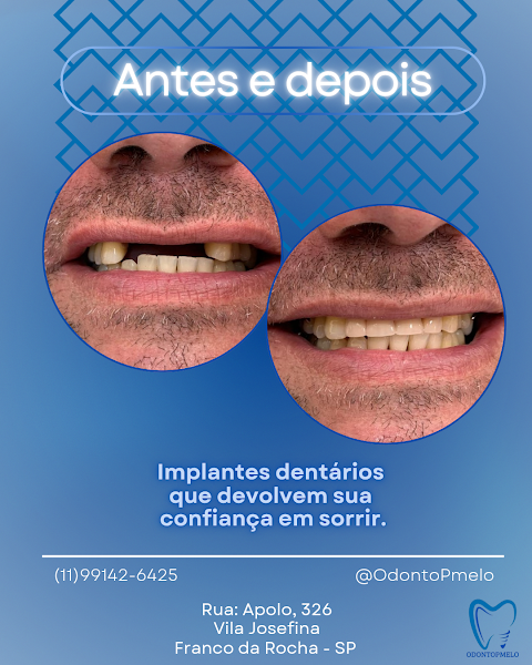 Foto 2 de OdontoPmelo