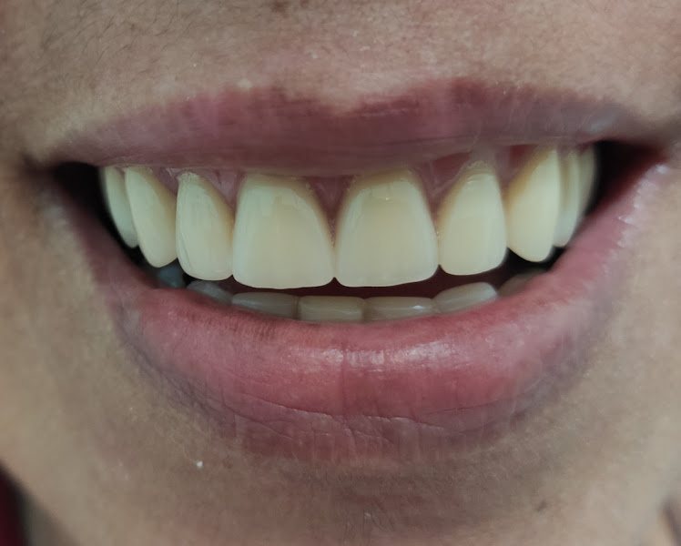 Foto 3 de Odontoprótese ltada