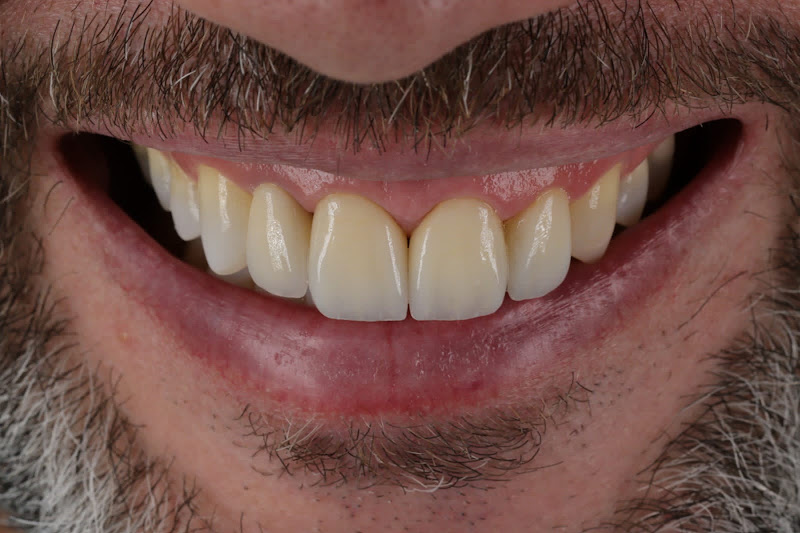 Foto 2 de ODONTORAPOSO - Odontologia Estética & Cursos