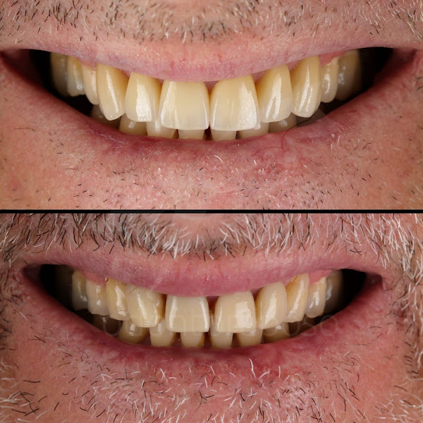 Foto 3 de ODONTORAPOSO - Odontologia Estética & Cursos