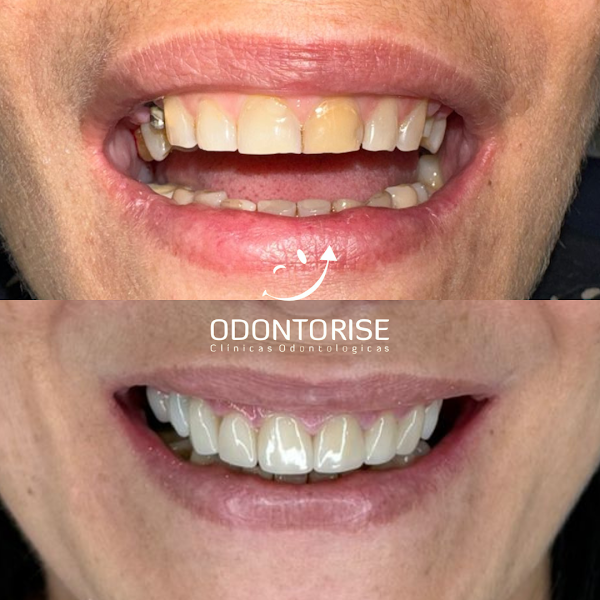Foto 2 de Odontorise - Clínica Odontológica