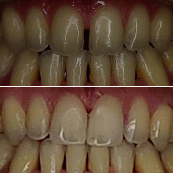 Foto 3 de Odontorise - Clínica Odontológica