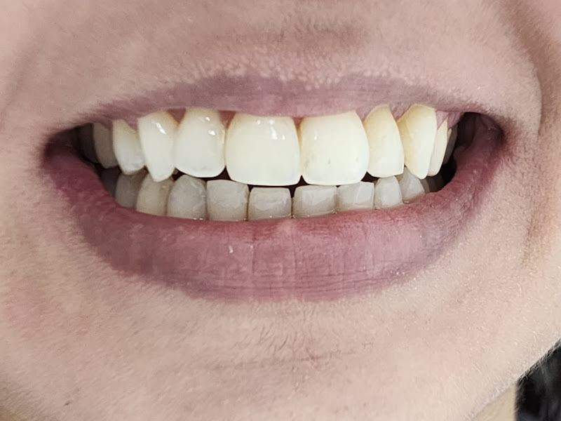 Foto 3 de OdontoSafe - Dentista