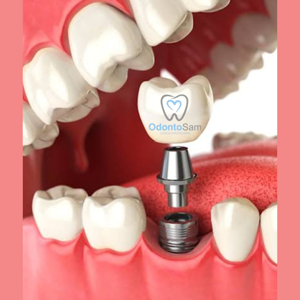 Foto 3 de Odontosam - Drª Samanta Qbar