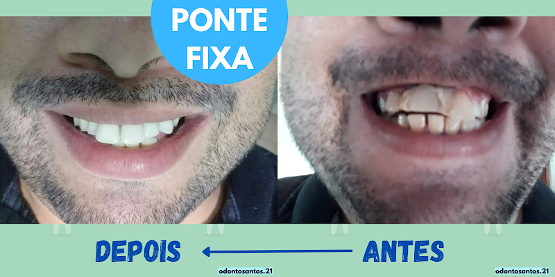 Foto 2 de OdontoSantos-Dentistas-consultório odontológico Dr.Mikeias