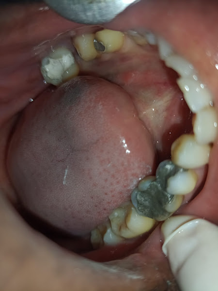 Foto 3 de Odontosil - Clínica Odontológica na Cidade Líder