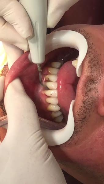 Foto 4 de Odontosil - Clínica Odontológica na Cidade Líder