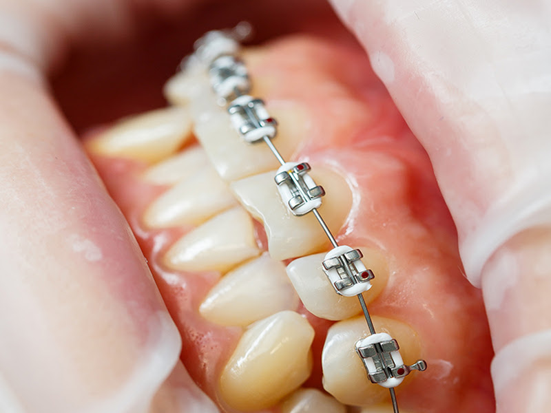 Foto 10 de Odontossel Sorocaba