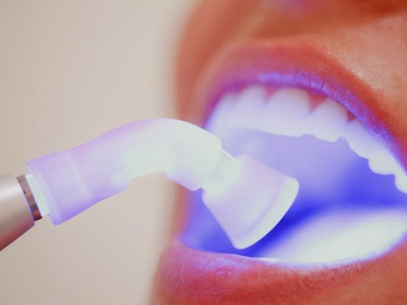 Foto 2 de Odontovel Centro de Atendimento Odontológico