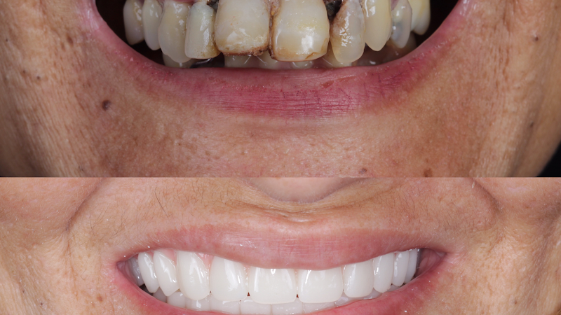 Foto 2 de Odontovic - Implantes Dentários - Madureira