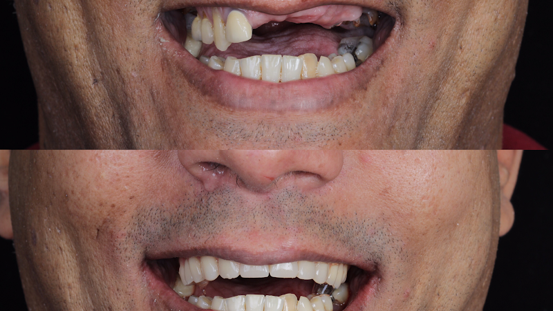 Foto 3 de Odontovic - Implantes Dentários - Madureira