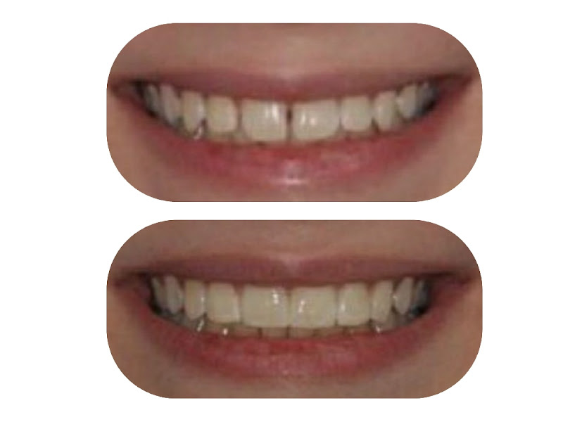 Foto 6 de OdontoVida - Saúde & Bem-Estar