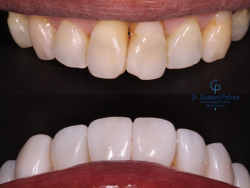 Foto 2 de OdontoVita