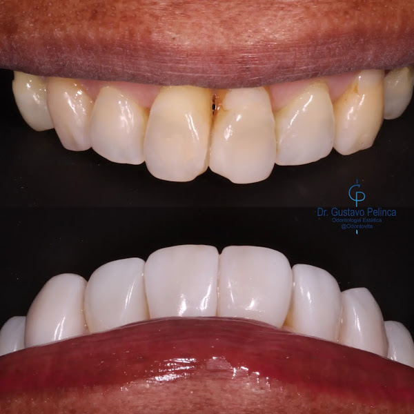 Foto 4 de OdontoVita