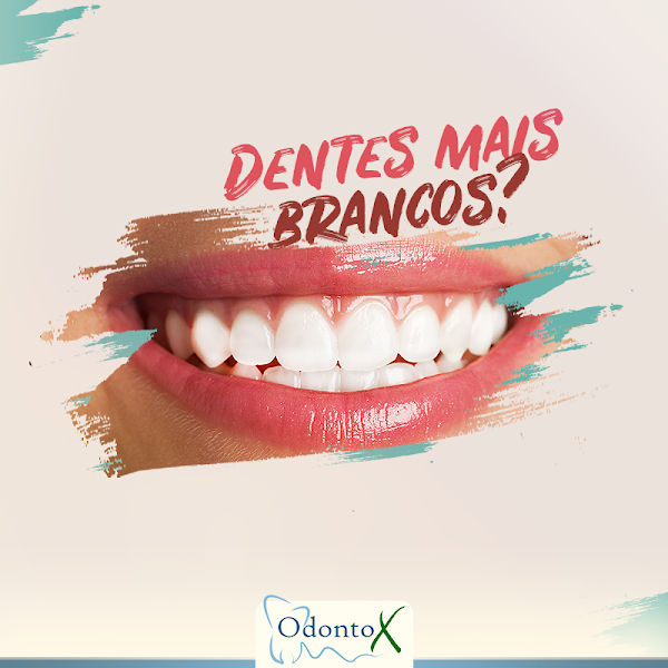 Foto 2 de Odontox ( Dr. Victor Castilho )