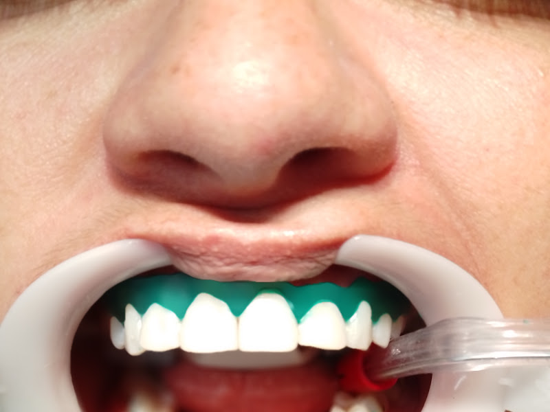 Foto 2 de Oeste Odonto Dr. Yokota