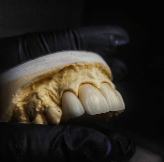 Foto 3 de officio dental lab