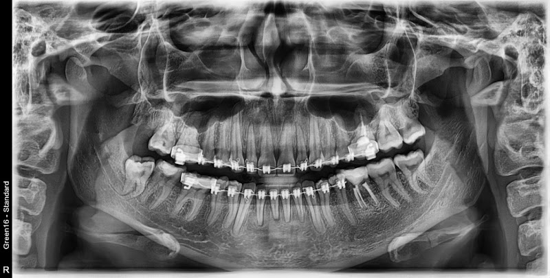 Foto 3 de Oi Digital Unidade Novo Hamburgo - RS