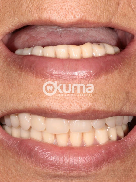 Foto 3 de Okuma Implante Estética - Dentista em Lauro de Freitas