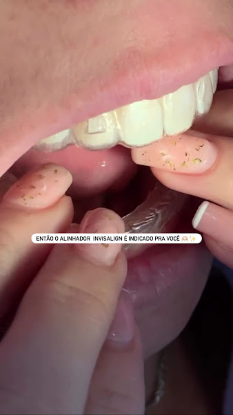 Foto 3 de Olicshevis Odontologia - Dentista, emergência 24h