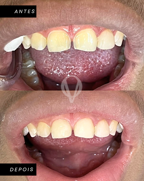 Foto 3 de Olivi - Odontologia Especializada