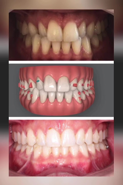 Foto 4 de One Odontologia Moema - Invisalign em Moema
