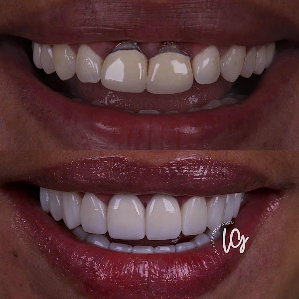 Foto 2 de Onion Odontologia carapicuiba Dr Leandro