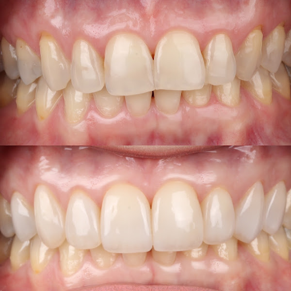 Foto 2 de Onix Odontologia Estética