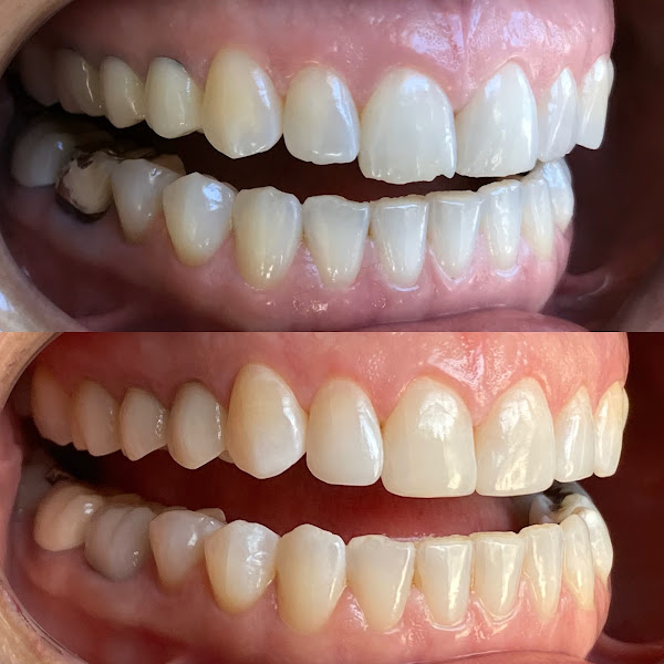 Foto 3 de Onix Odontologia Estética