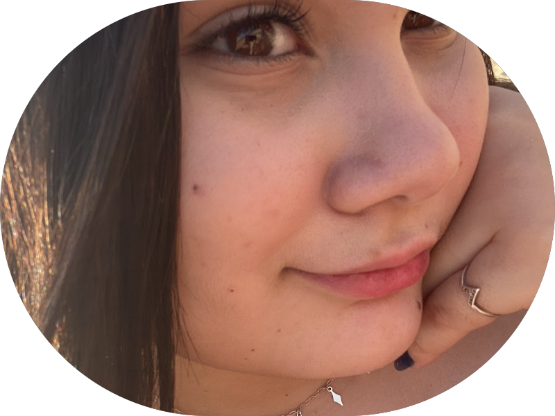 Foto 6 de Onne Odontologia | Dentista Águas Claras | Implante Dentário Aparelho Invisível Invisalign