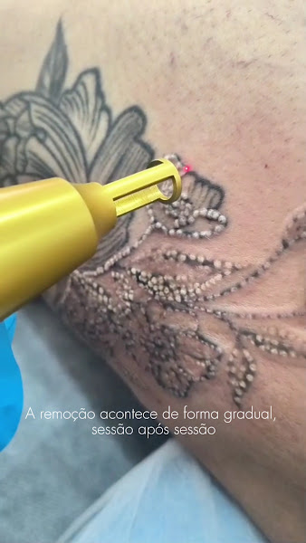 Foto 2 de Open Estética - Clínica de Estética em Mogi Guaçu