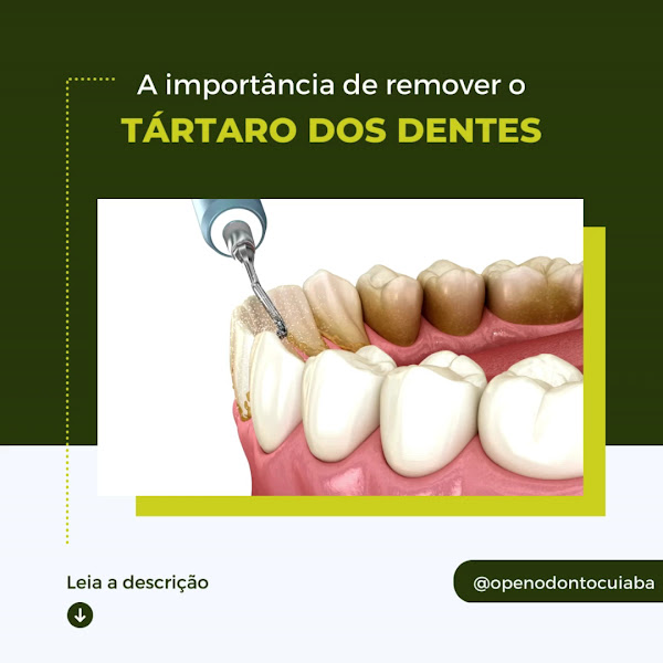 Foto 3 de Open Odonto