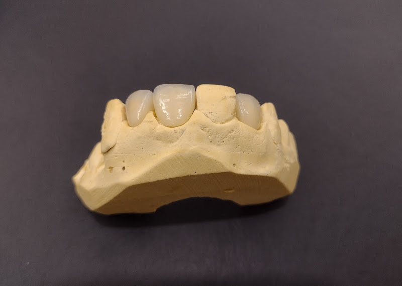 Foto 3 de Operlab Próteses Odontológicas