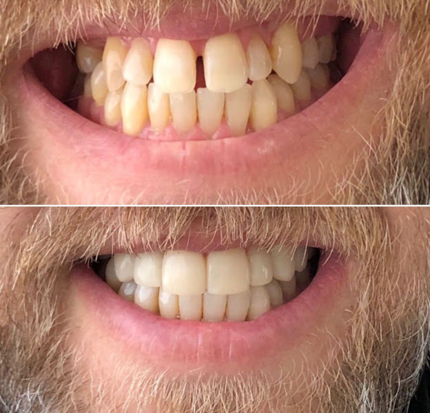 Foto 2 de ORAL BRASIL IMPLANTES - SOB NOVA DIREÇÃO