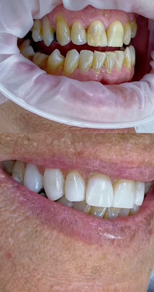 Foto 3 de ORAL BRASIL IMPLANTES - SOB NOVA DIREÇÃO