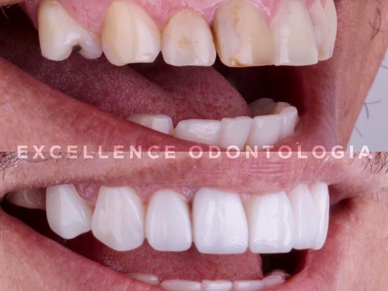 Foto 7 de Oral Centter Clínicas Odontológicas Lauro de Freitas BA