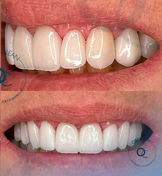 Foto 2 de Oral Clean