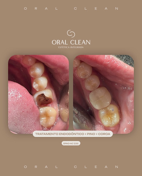 Foto 3 de Oral Clean- Estética Integrada