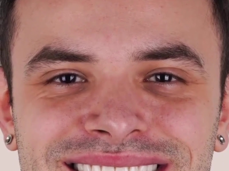 Foto 6 de Oral Clin - Clínica Odontológica - Implante dentário