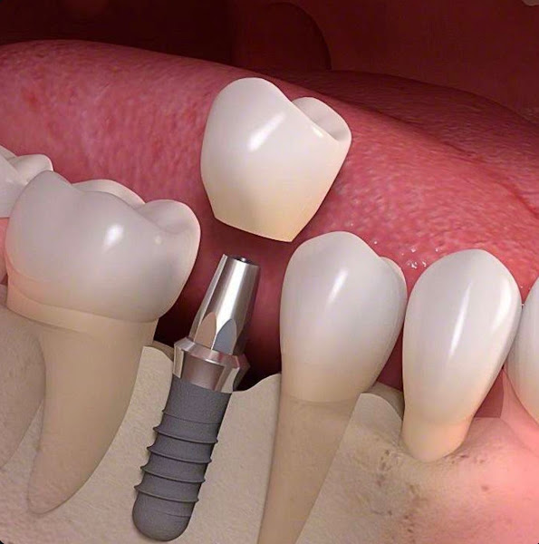 Foto 3 de Oral Clin VCA - Clínica Odontológica