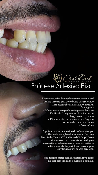 Foto 5 de Oral Dent Maceió