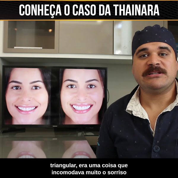 Foto 2 de Oral Dente - Betim MG | Implantodontia | Ortodontia | Clínico geral | Facetas e lentes