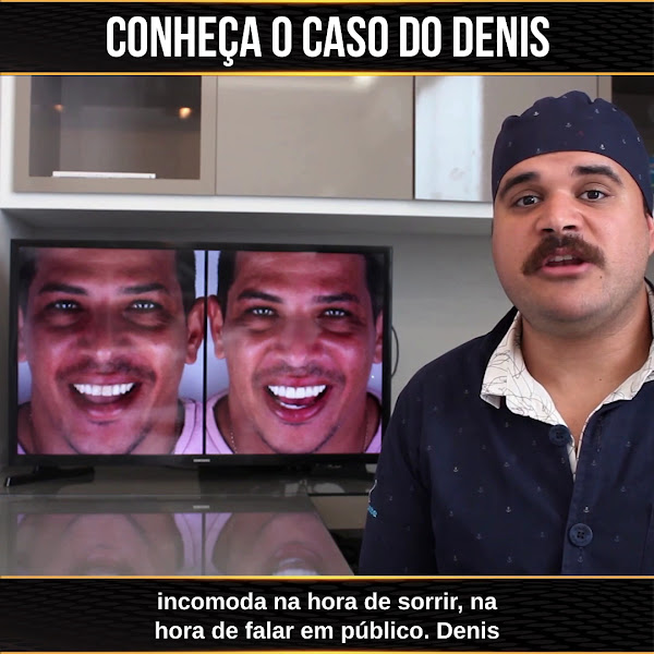 Foto 3 de Oral Dente - Betim MG | Implantodontia | Ortodontia | Clínico geral | Facetas e lentes